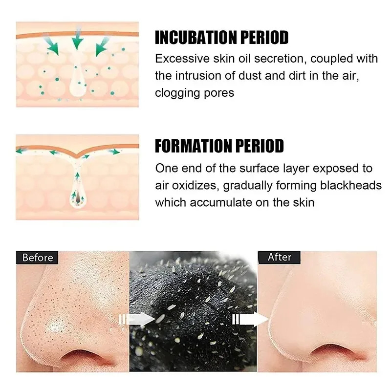10/150PCS Blackhead Remove Mas - Skincare Indonesia 评论和价格